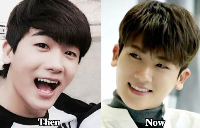 Park Hyung Sik Before Plastic Surgery 1